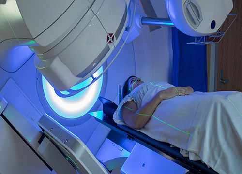 La radiothérapie dans le traitement du cancer de l'utérus