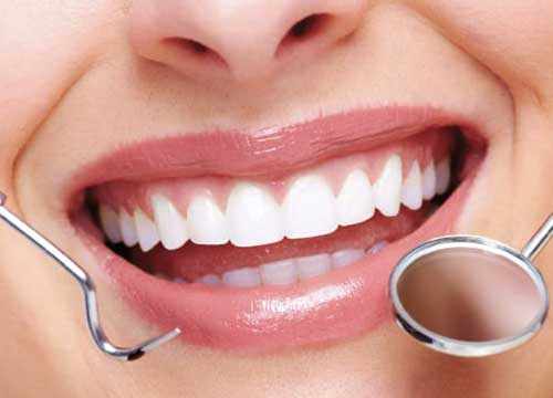 Beau sourire esthétique