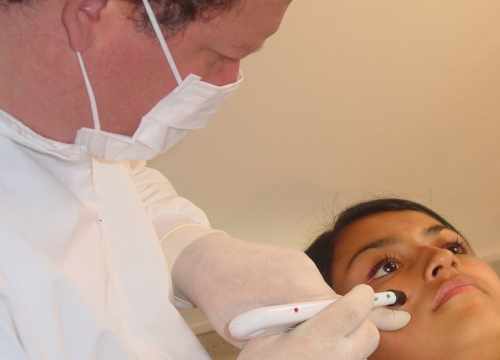 acupuncture sans aiguille