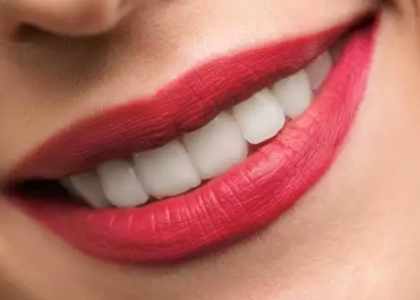 6 astuces pour un blanchiment dentaire naturel