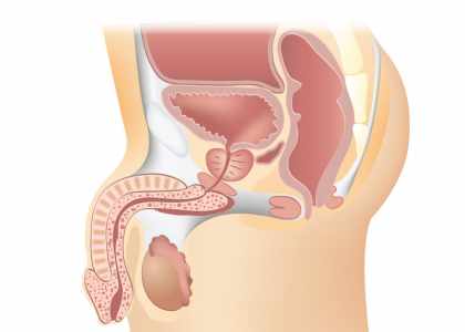 Chirurgie de la prostate en Turquie