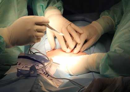 chirurgie esthétique