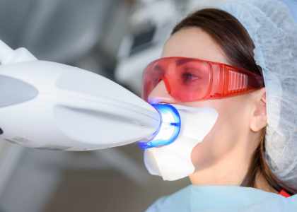 blanchiment dentaire