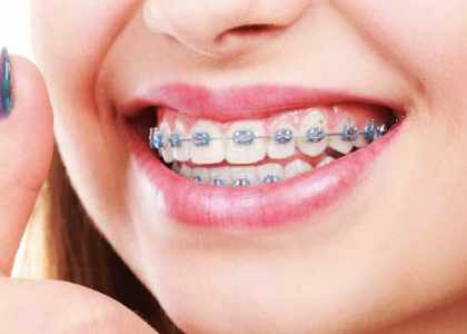 5 raisons d'aller consulter un orthodontiste aujourd'hui