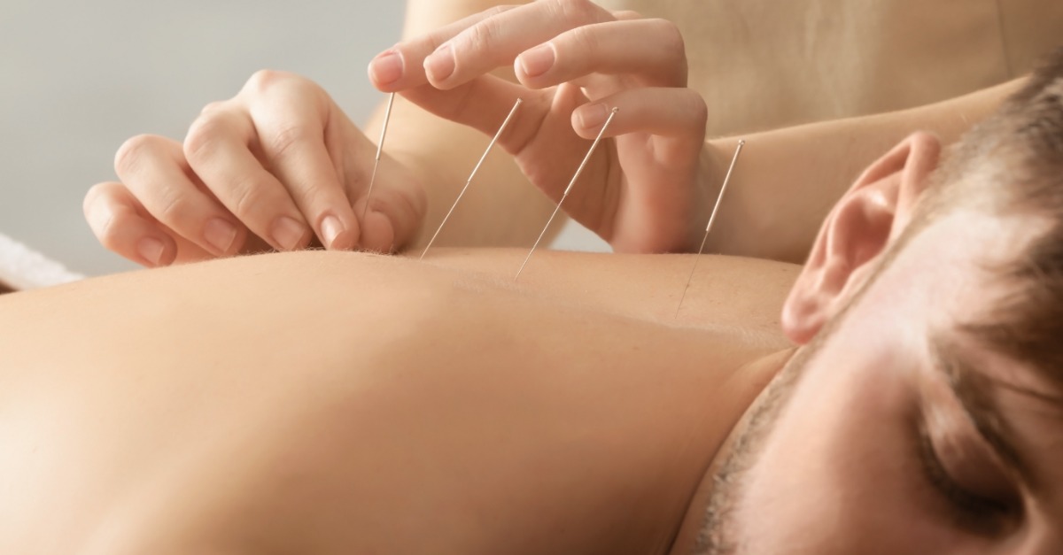 acupuncture pour la santé