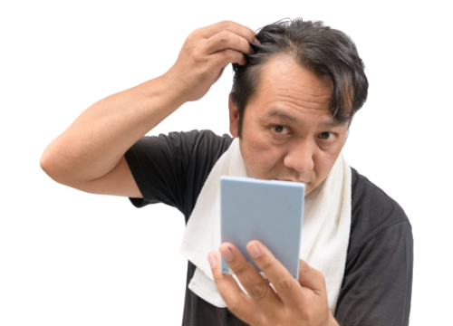 Homme qui regarde sa calvitie devant un miroir