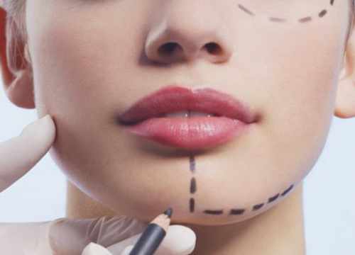 Dr Nassim SIDHOUM, chirurgien esthétique Rennes
