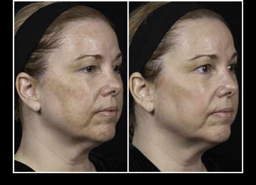 MedEspoir - Chirurgie esthétique Tunisie