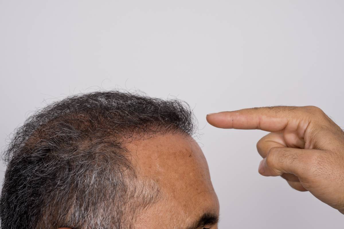 Hair Repair Formation