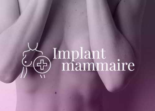 Implant mammaire - Blog