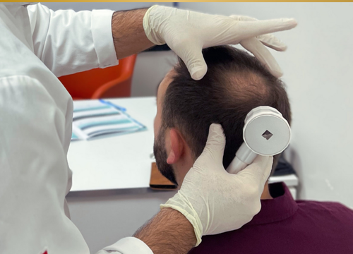 Chirurgien Klineva auscultant un patient pour préparer une greffe capillaire