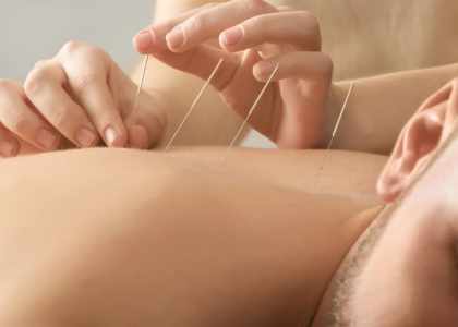 acupuncture pour la santé