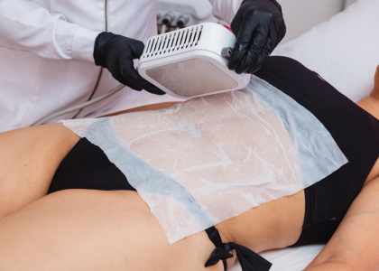 les lingettes cryolipoyse